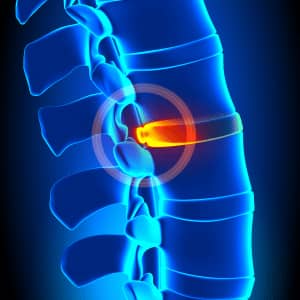 Orthopedic Spine Problem