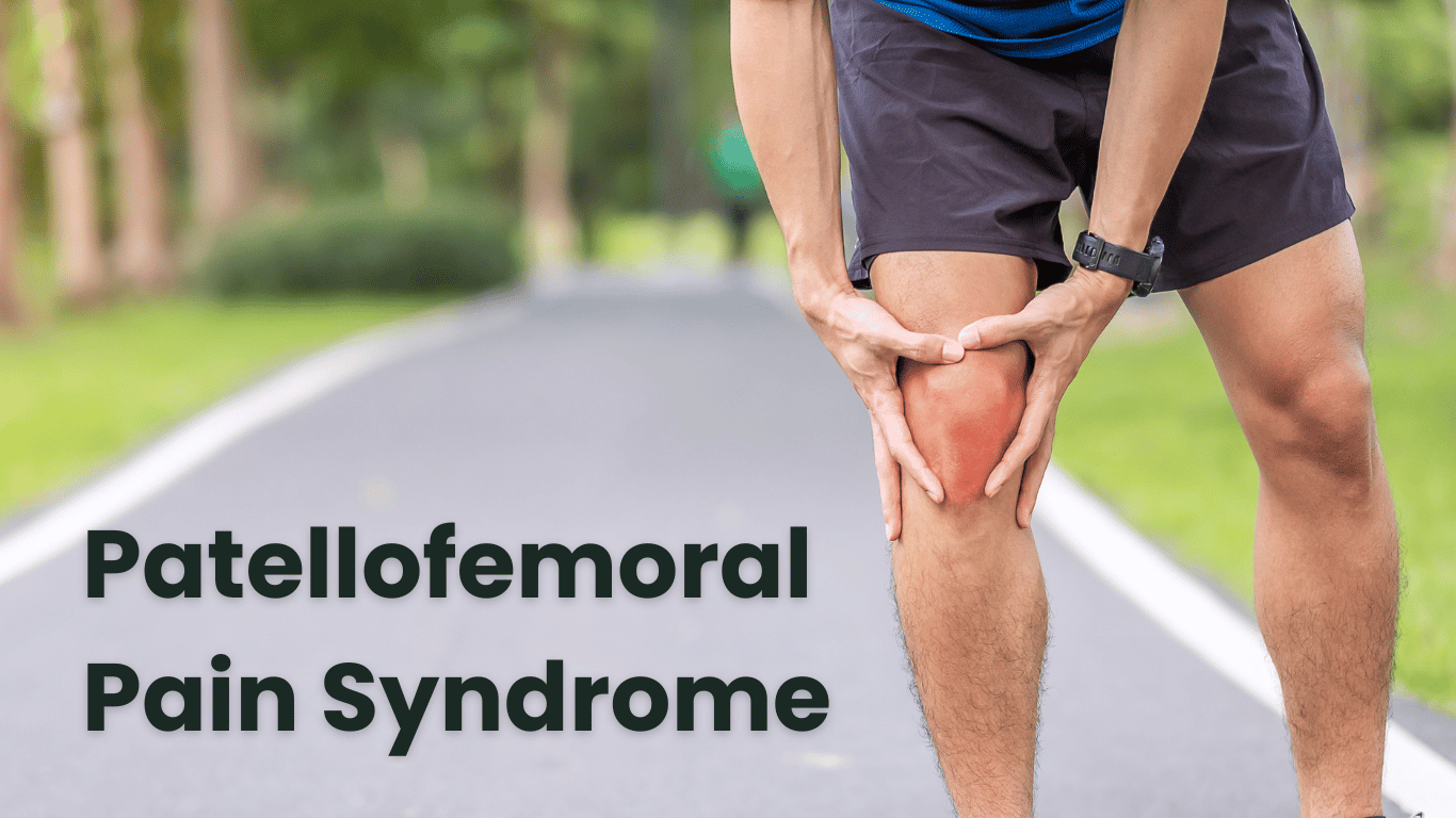 Patellofemoral Pain Syndrome: Guide by Dr. Abhishek Chaturvedi