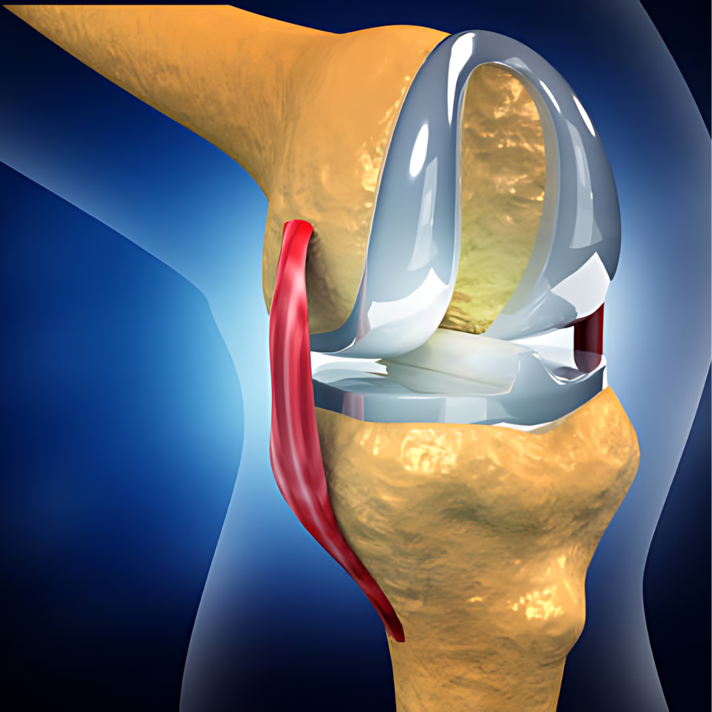 Joint Replacement Surgery