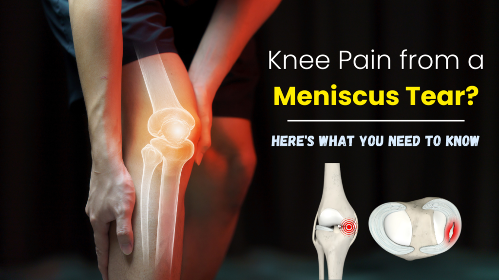 Meniscus Tear Complete Blog