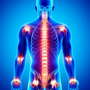 Joint Pain and Arthritis